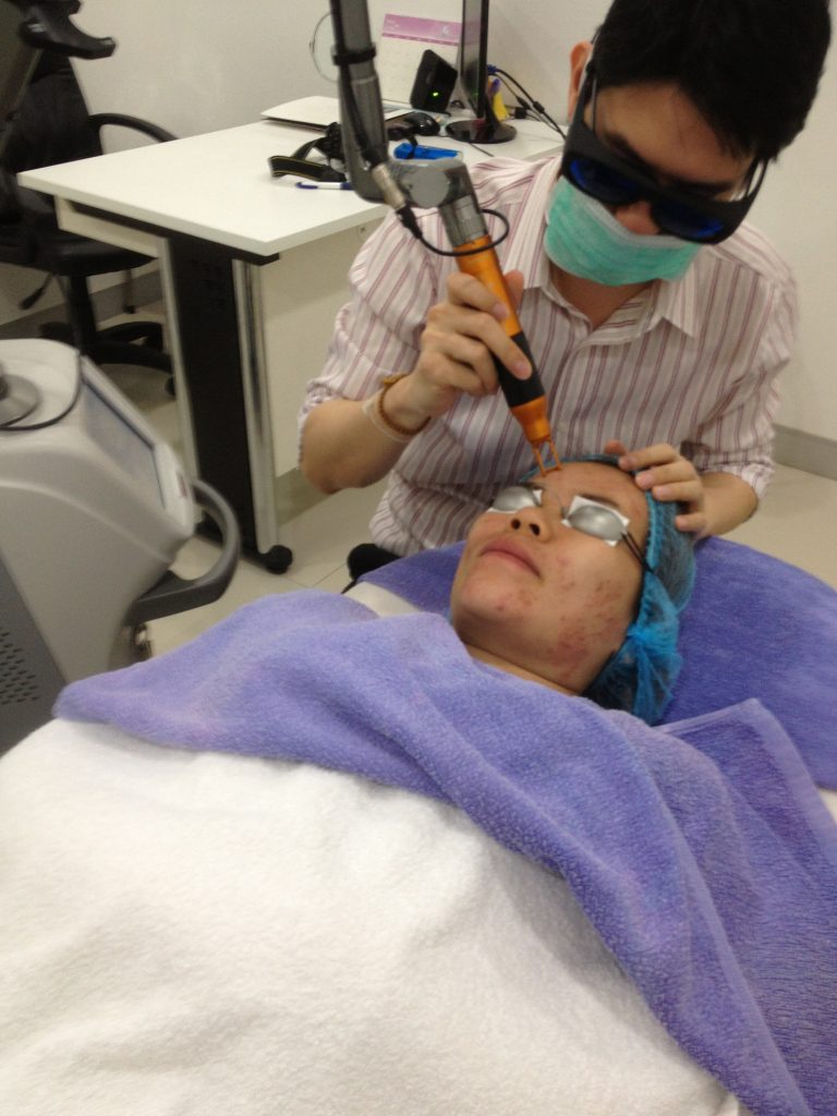 เลเซอร์รอยแดง (PDL) คริสตัลคลินิก มหาสารคาม เลเซอร์รอยแดง(Pulsed Dye Laser) คริสตัลคลินิก มหาสารคาม