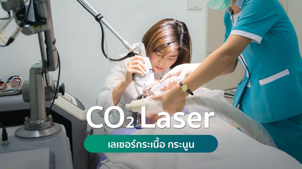 เลเซอร์กระเนื้อ กระนูน Co2 Laser
