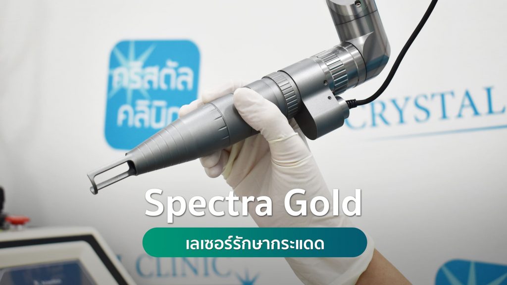 spectra gold เลเซอร์รักษากระแดด คริสตัลคลินิก มหาสารคาม