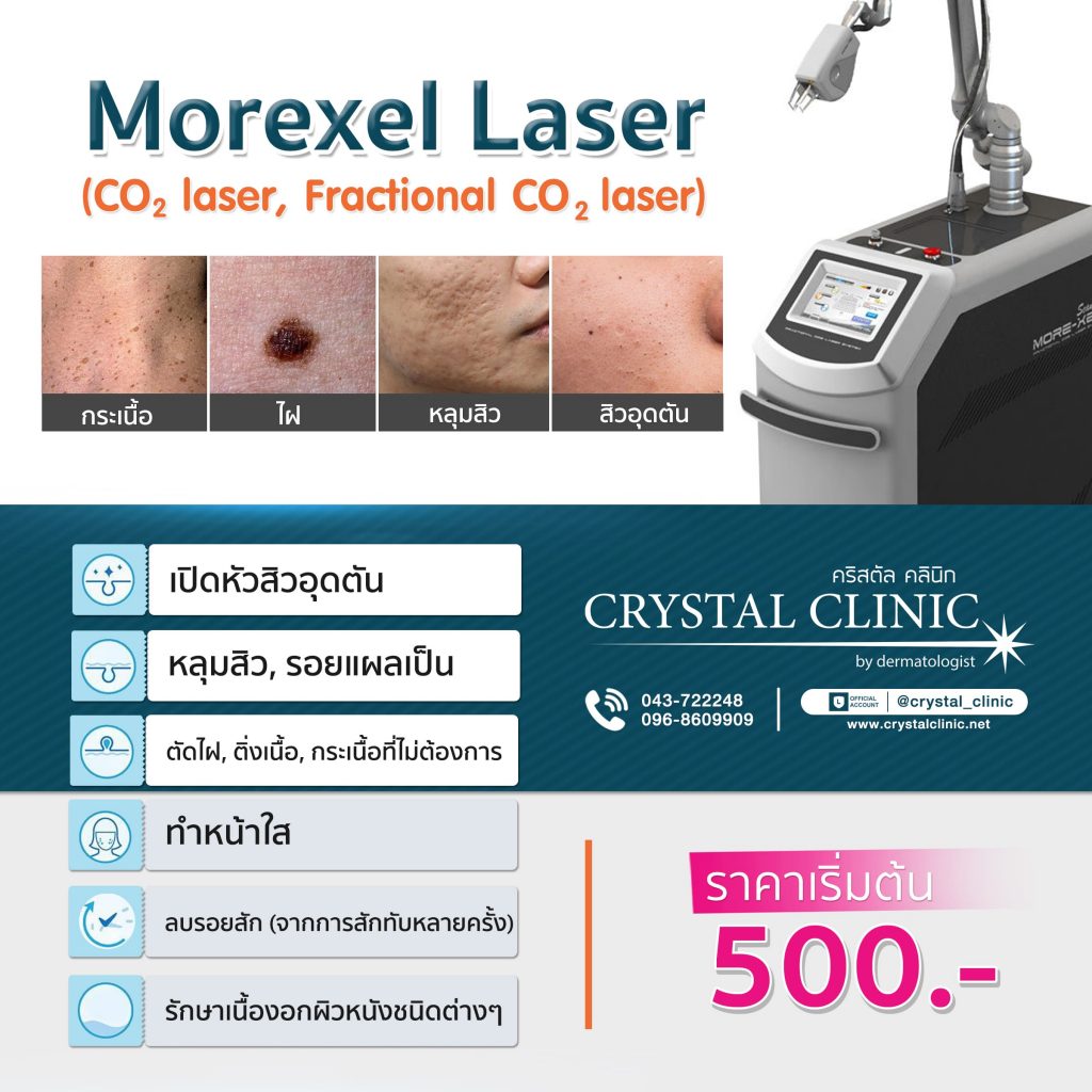 CO2 Laser Morexel Laser
