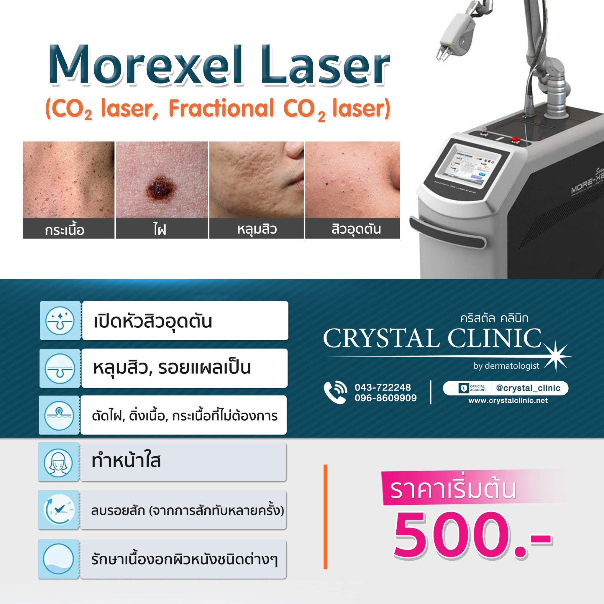 CO2 Laser Morexel Laser CO2 Laser Morexel Laser