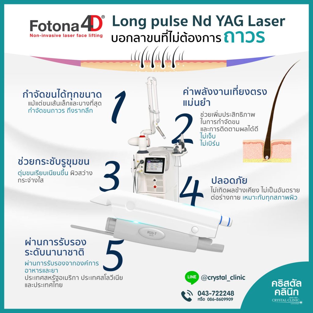 Long pulse Nd Yag Laser เลเซอร์กำจัดขนถาวร คริสตัลคลินิก มหาสารคาม Long Pulse Nd YAG Laser เลเซอร์กำจัดขนถาวร คริสตัลคลินิก มหาสารคาม
