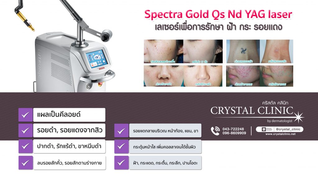 Spectra Gold Qs Nd YAG Laser Spectra Gold Qs Nd YAG Laser