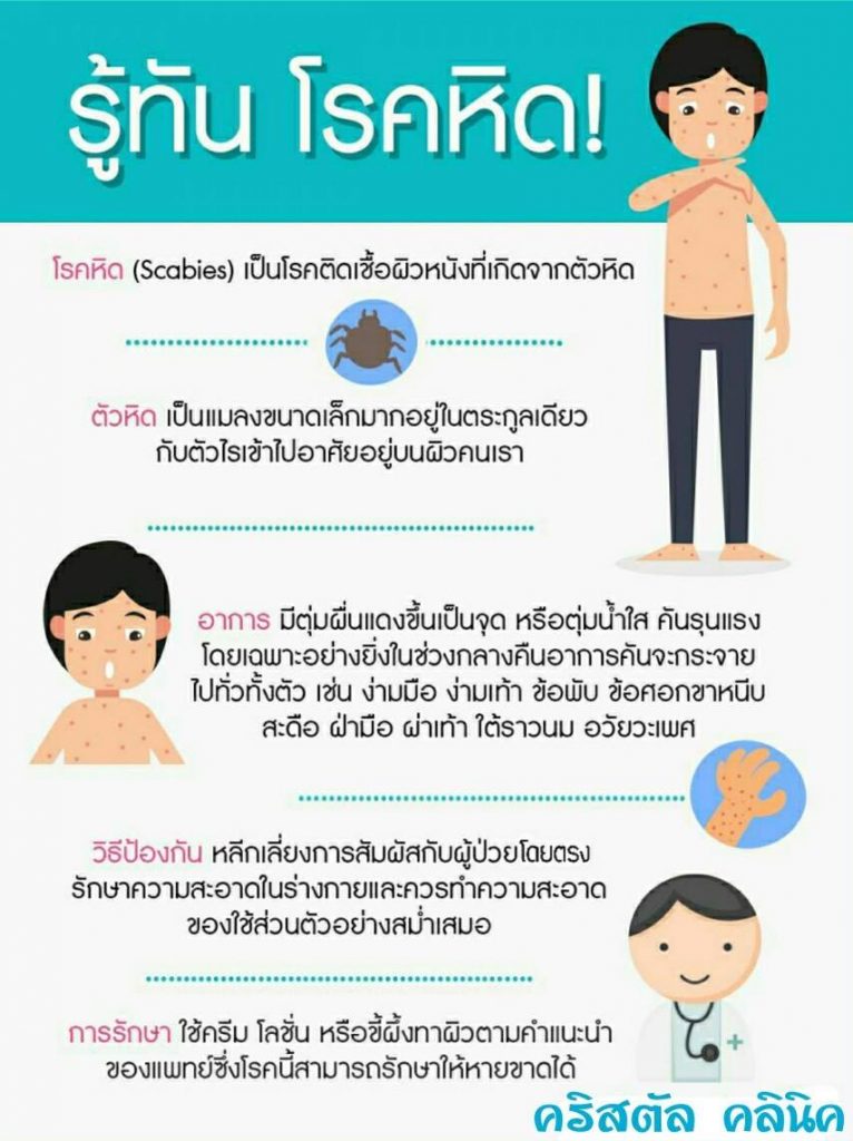 รู้ทัน โรคหิด