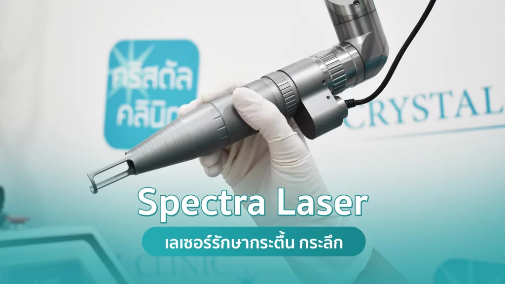 Spectra Laser รักษากระตื้น กระลึก คริสตัลคลินิก มหาสารคาม Spectra Laser รักษากระตื้น กระลึก คริสตัลคลินิก มหาสารคาม