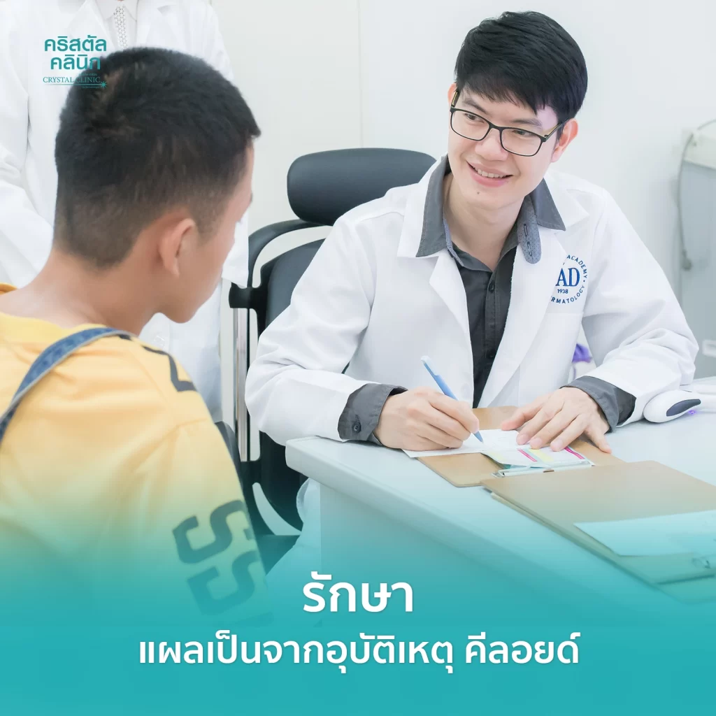 รักษาแผลเป็น แผลเป็นนูน(คีลอยด์)