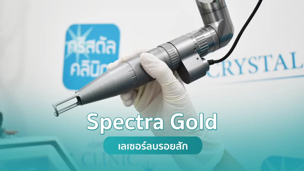 เลเซอร์ลบรอยสัก Spectra Gold Laser คริสตัลคลินิก มหาสารคาม เลเซอร์ลบรอยสัก Spectra Gold Laser คริสตัลคลินิก มหาสารคาม