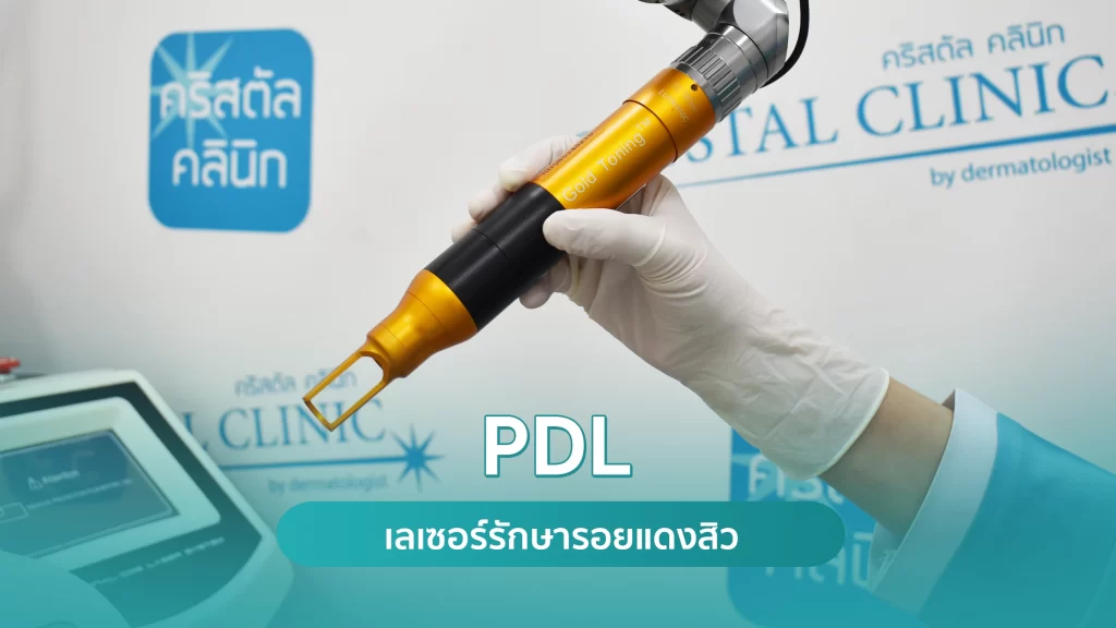 PDL Laser รักษารอยแดง รอยแดงสิว ด้วยเลเซอร์ คริสตัลคลินิก PDL Laser รักษารอยแดง รอยแดงสิว ด้วยเลเซอร์ คริสตัลคลินิก