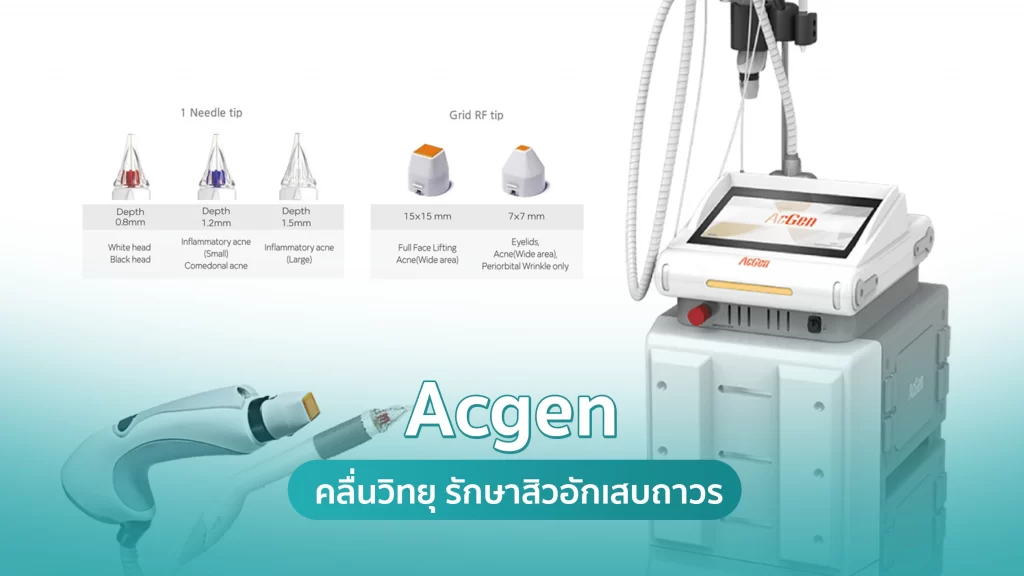 Acgen คลื่นวิทยุทำลายต่อมไขมัน รักษาสิวอักเสบถาวร Acgen คลื่นวิทยุทำลายต่อมไขมัน รักษาสิวอักเสบถาวร คริสตัลคลินิก มหาสารคาม