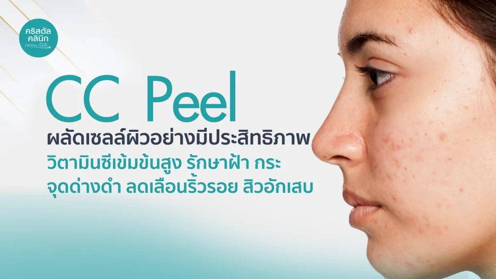 CC Peel ผลัดเซลล์ผิว ด้วยวิตามินเข้มข้นสูง รักษาฝ้า กระ จุดด่างดำ ลดเลือดริ้วรอย สิวอักเสบ สิวหัวช้าง สิวอุดตัน CC Peel ผลัดเซลล์ผิว ด้วยวิตามินเข้มข้นสูง รักษาฝ้า กระ จุดด่างดำ ลดเลือดริ้วรอย สิวอักเสบ สิวหัวช้าง สิวอุดตัน