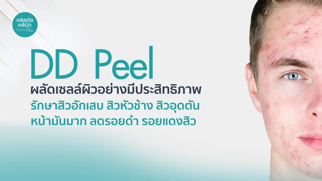 DD Peel ผลัดเซลล์ผิว รักษาสิวอักเสบ สิวหัวช้าง สิวอุดตัน หน้ามันมาก ลดรอยดำ รอยแดงจากสิว DD Peel ผลัดเซลล์ผิว รักษาสิวอักเสบ สิวหัวช้าง สิวอุดตัน หน้ามันมาก ลดรอยดำ รอยแดงจากสิว