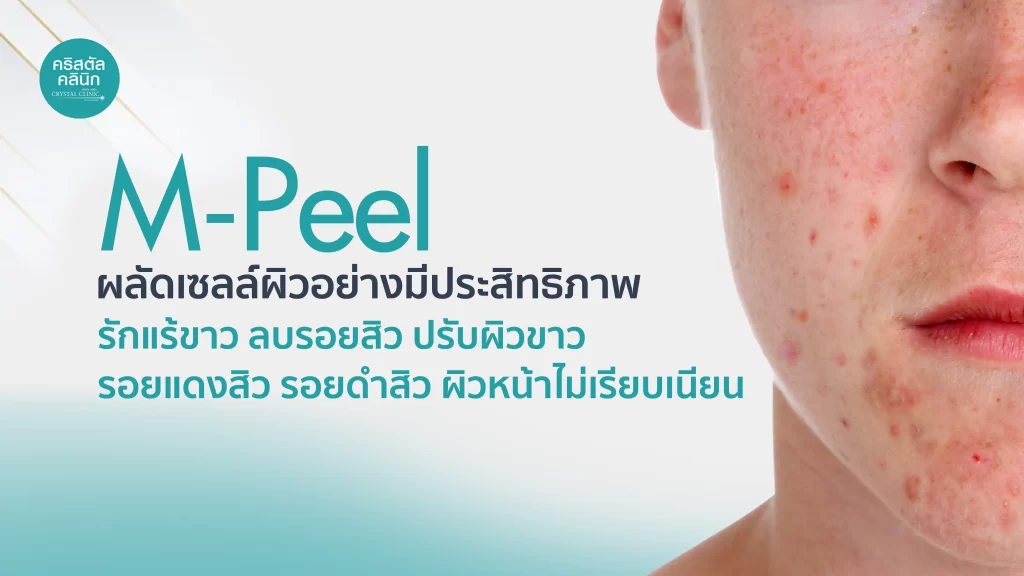 M-Peel ผลัดเซลล์ผิวอย่างมีประสิทธิภาพ รักแร้ขาว ลบรอยสิว ปรับผิวขาว รอยแดงสิว รอยดำสิว ผิวหน้าไม่เรียบเนียน M-Peel ผลัดเซลล์ผิวอย่างมีประสิทธิภาพ รักแร้ขาว ลบรอยสิว ปรับผิวขาว รอยแดงสิว รอยดำสิว ผิวหน้าไม่เรียบเนียน