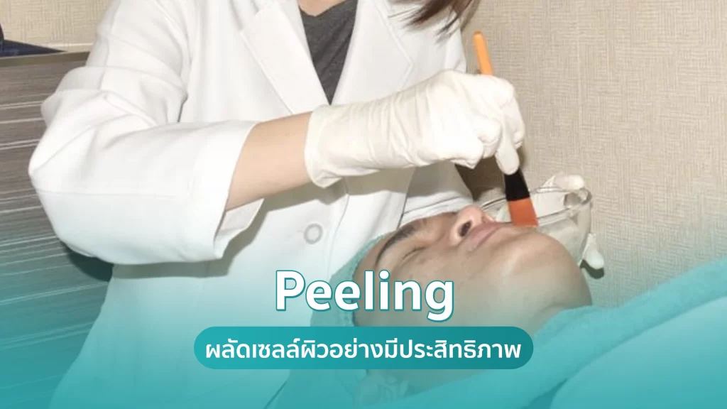 Peeling ผลัดเซลล์ผิวอย่างมีประสิทธิภาพ คริสตัลคลินิก มหาสารคาม Peeling ผลัดเซลล์ผิวอย่างมีประสิทธิภาพ
