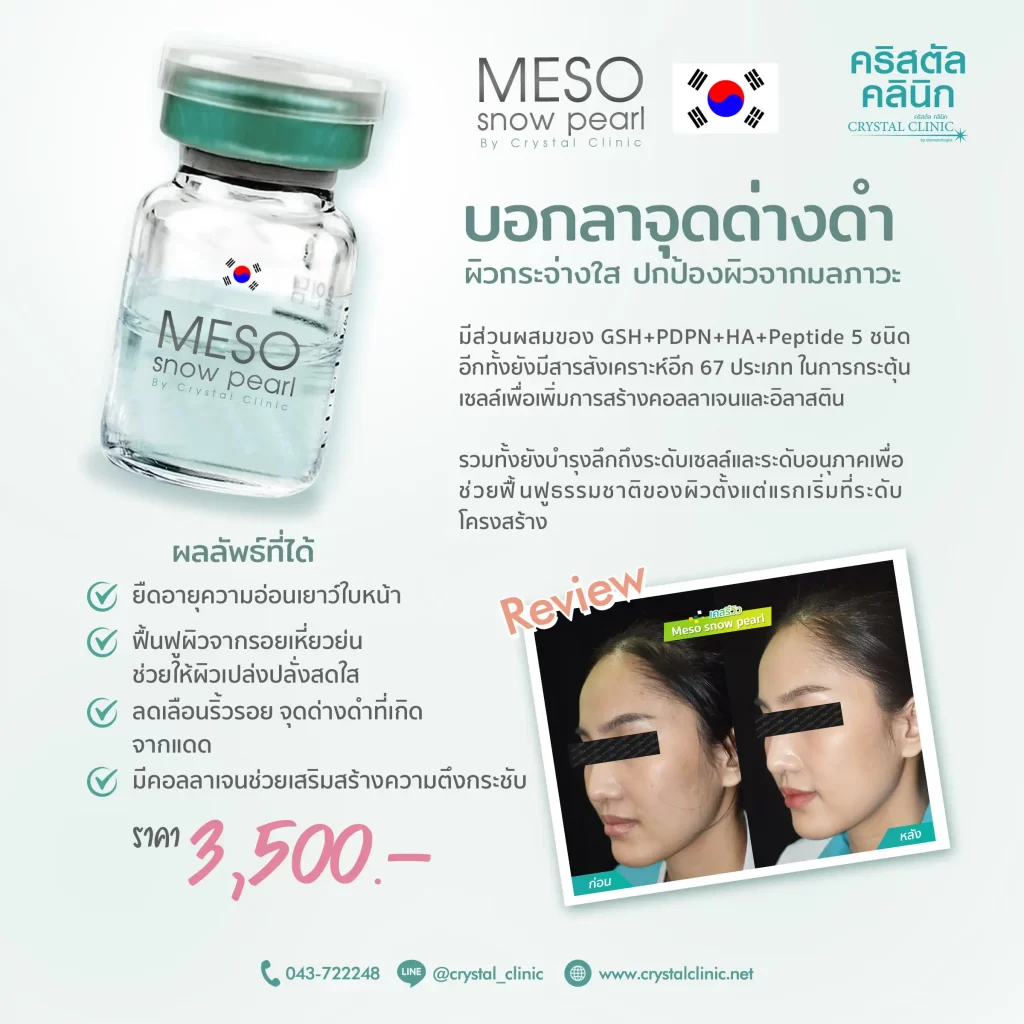 Meso snow pearl ผิวกระจ่างใส ปกป้องผิวจากมลภาวะ คริสตัลคลินิก มหาสารคาม Meso snow pearl เมโสผิวกระจ่างใส คริสตัลคลินิก มหาสารคาม