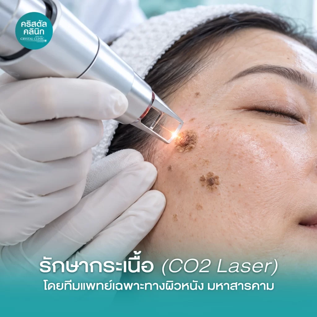 รักษากระเนื้อ-Cover-2