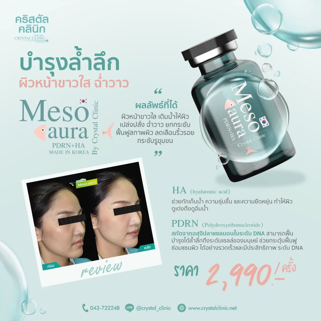 Meso aura Review คริสตัลคลินิก มหาสารคาม บำรุงล้ำลึก ผิวหน้าขาวใส ฉ่ำวาว ด้วย "Meso Aura"