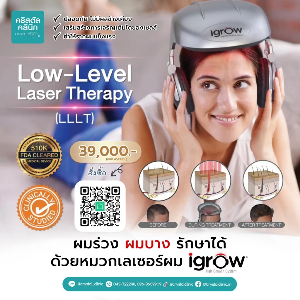 Igrow หมวกเลเซอร์กระตุ้นเส้นผม รักษาผมร่วง ผมบาง