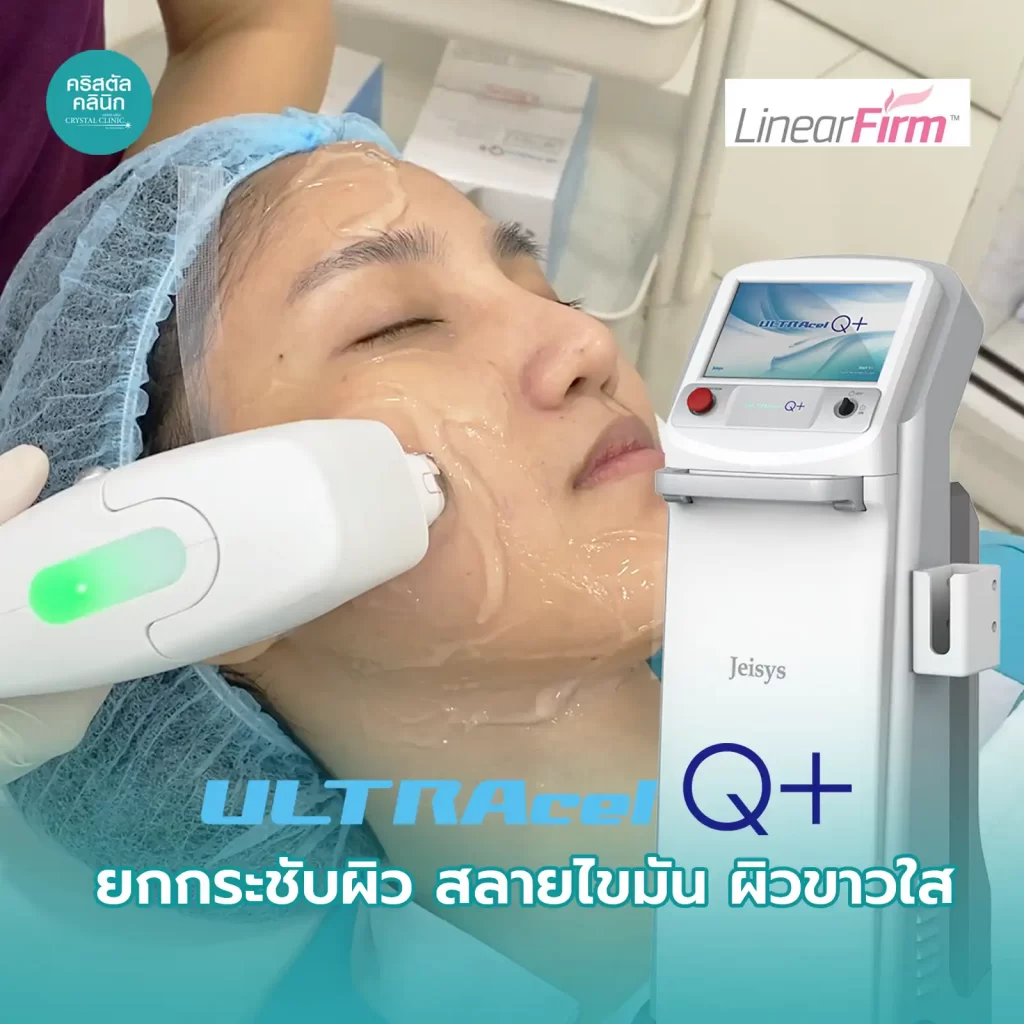 Ultracel Q+ HIFU ยกกระชับผิว สลายไขมัน ผิวขาวใส คริสตัลคลินิก มหาสารคาม