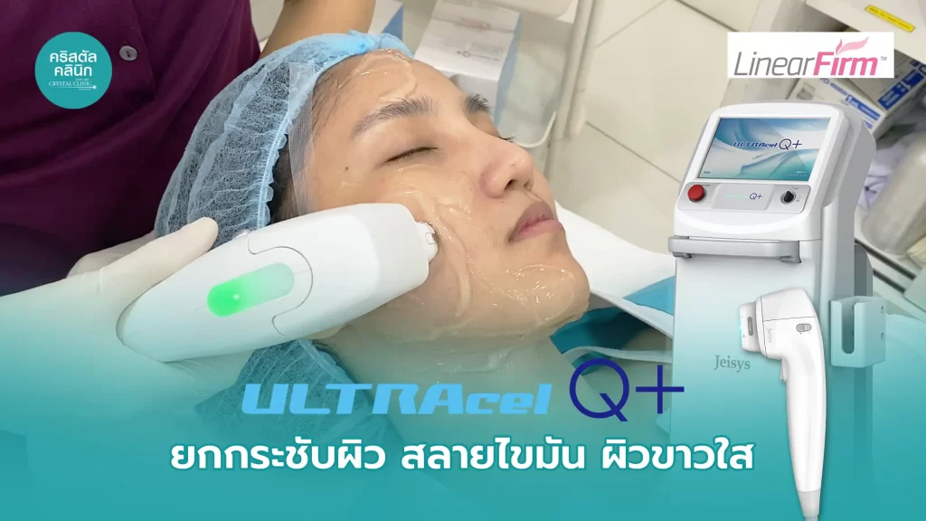 ULTRAcel Q+ HIFU ยกกระชับผิว สลายไขมัน ผิวขาวใส คริสตัลคลินิก มหาสารคาม ULTRAcel Q+ HIFU ยกกระชับผิว สลายไขมัน ผิวขาวใส คริสตัลคลินิก มหาสารคาม