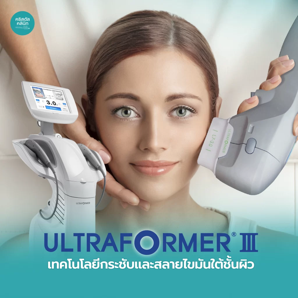 ultraformeriii เทคโนโลยีกระชับ สลายไขมันใต้ชั้นผิว คริสตัลคลินิก มหาสารคาม