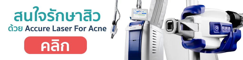 ลงทะเบียนรับสิทธิพิเศษ ด้วย Accure Laser เลเซอร์รักษาสิว สนใจรักษาสิว ด้วย Accure Laser For Acne เตรียมพบกับ Accure Laser For Acne เครื่องเลเซอร์ Accure เลเซอร์ทำลายต่อมไขมัน รักษาสิว
