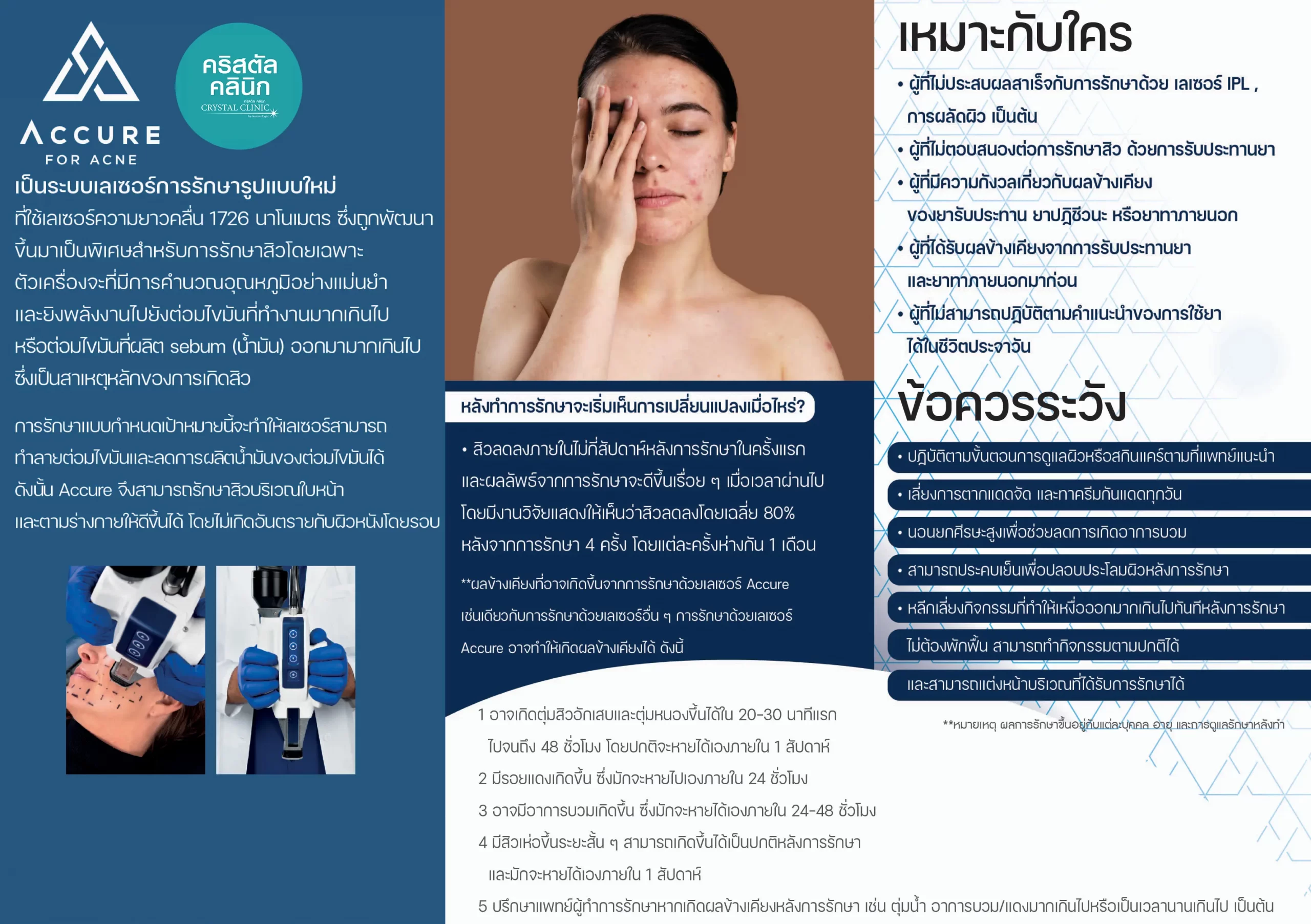 โบรชัวร์ Accure Laser โบรชัวร์ Accure Laser Accure Laser For Acne (คาร์แคร์เลเซอร์) เลเซอร์ทำลายไขมันส่วนเกินไขมันในเลือด (ซึ่งรวมถึงอาหารจานหลักสิว)