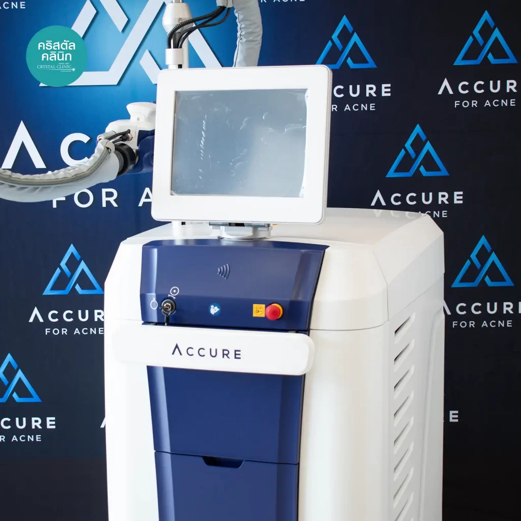 แอคคิวเรเตอร์เลเซอร์ Accure Laser นวัตกรรมใหม่ล่าสุดของเทคโนโลยีและนวัตกรรมการรักษาสิวครั้งแรกของโลก เป็นอุปกรณ์ที่ทำลายต่อมไขมันเพื่อแก้ปัญหาสิวที่ต้นเหตุ ไม่ต้องทนทุกข์ทรมานกับการใช้ยารักษาสิวแบบรับประทานหรือการรักษาแบบเฉพาะที่อีกต่อไป รับข้อเสนอ Accure Laser ที่ดีที่สุดและคุ้มราคาที่สุดได้แล้ววันนี้ที่คริสตัลคลินิก มหาสารคาม