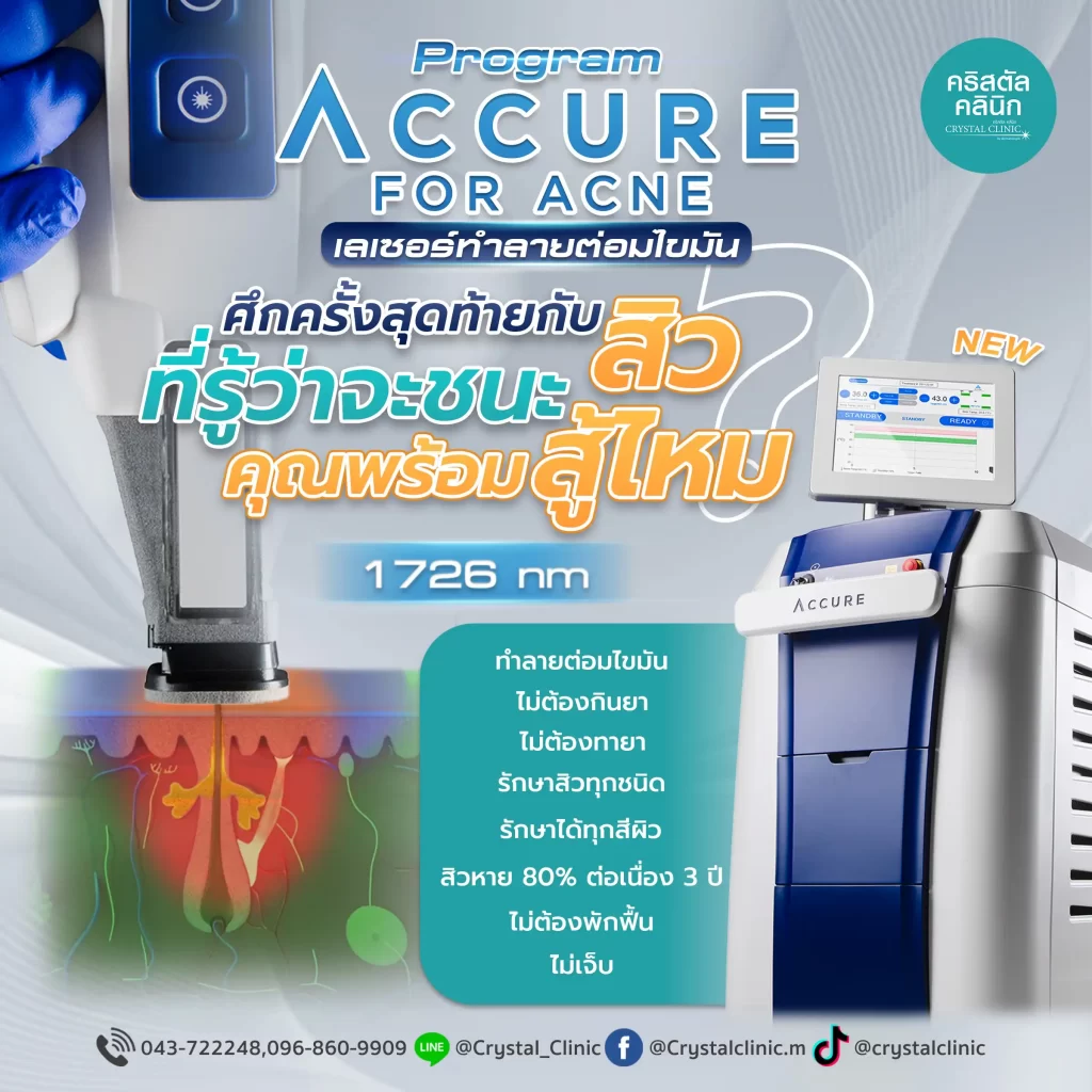 Accure Laser For Acne (สารคดีเลเซอร์) เลเซอร์ทำลายไขมันที่ไขมันเพียงแค่นั้น Accure Laser For Acne (สารคดีเลเซอร์) เลเซอร์ทำลายไขมันที่ไขมันเพียงแค่นั้น