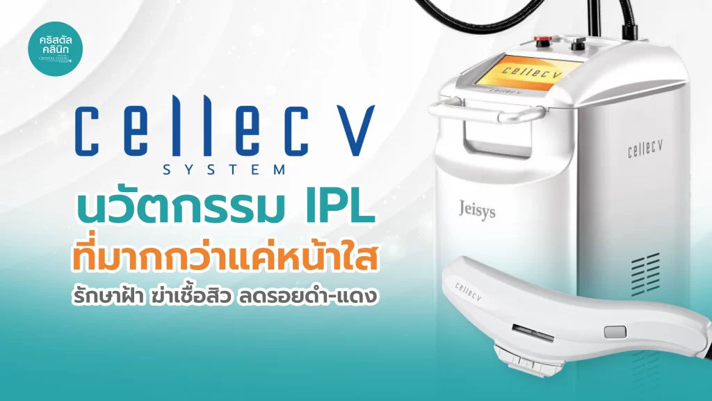Cellec V นวัตกรรม IPL (Intense Pulsed Light) ใหม่ล่าสุดที่มากกว่าแค่หน้าใส พร้อมราคาที่ดีที่สุด จากประเทศเกาหลี Cellec V นวัตกรรม IPL (Intense Pulsed Light) ใหม่ล่าสุดที่มากกว่าแค่หน้าใส พร้อมราคาที่ดีที่สุด จากประเทศเกาหลี
