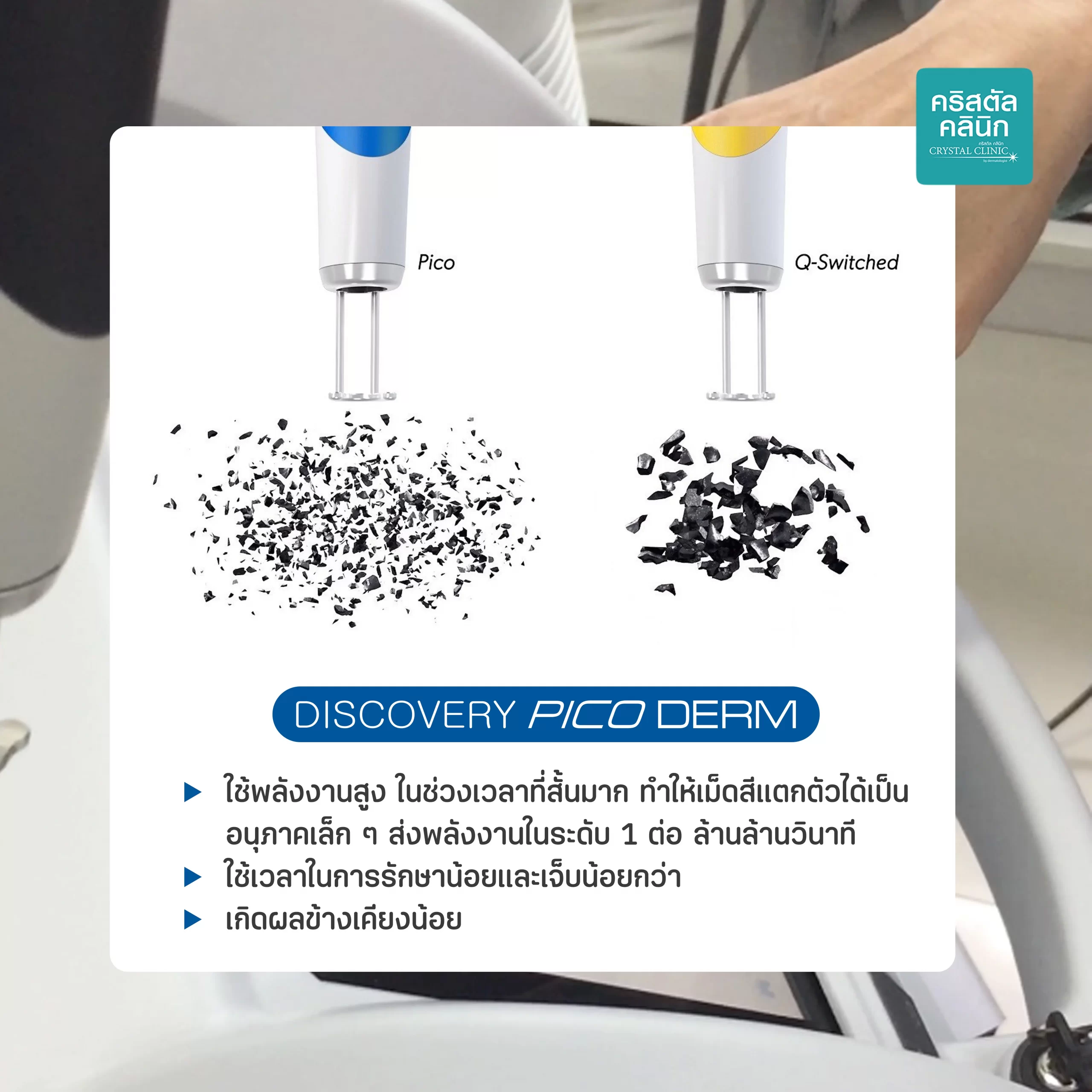 คืนผิวเรียบเนียนใส ไร้ริ้วรอย ด้วยพิโค่เลเซอร์ Discovery Pico Derm Laser เลเซอร์ที่วงการแพทย์ผิวหนังและความงามทั่วโลกยอมรับ