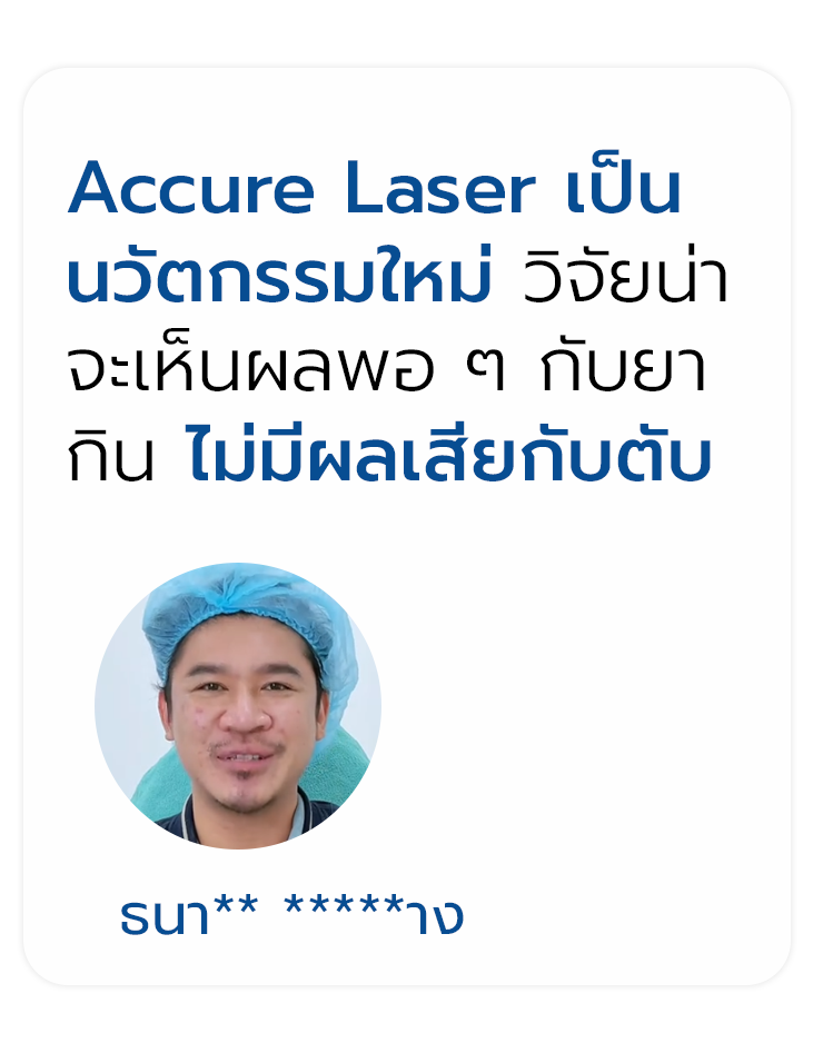 review accure laser 3