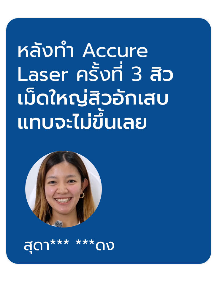 review accure laser 6