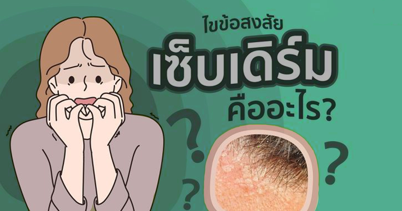 เซ็บเดิร์ม (Seborrheic Dermatitis) คืออะไร เซ็บเดิร์มเกิดจากอะไร เซ็บเดิร์มรักษาอย่างไร