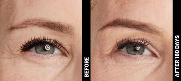 blinder-debbie-brow-after-180-768x344