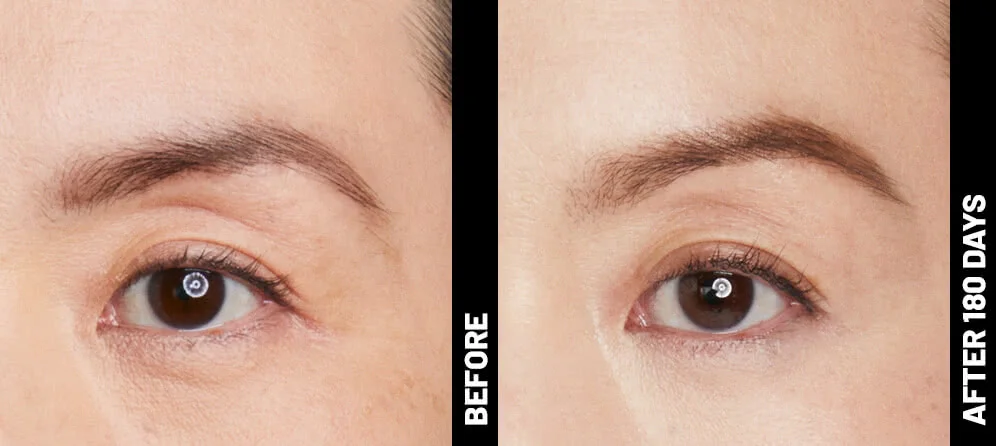 blinder-grace-brow-after-180