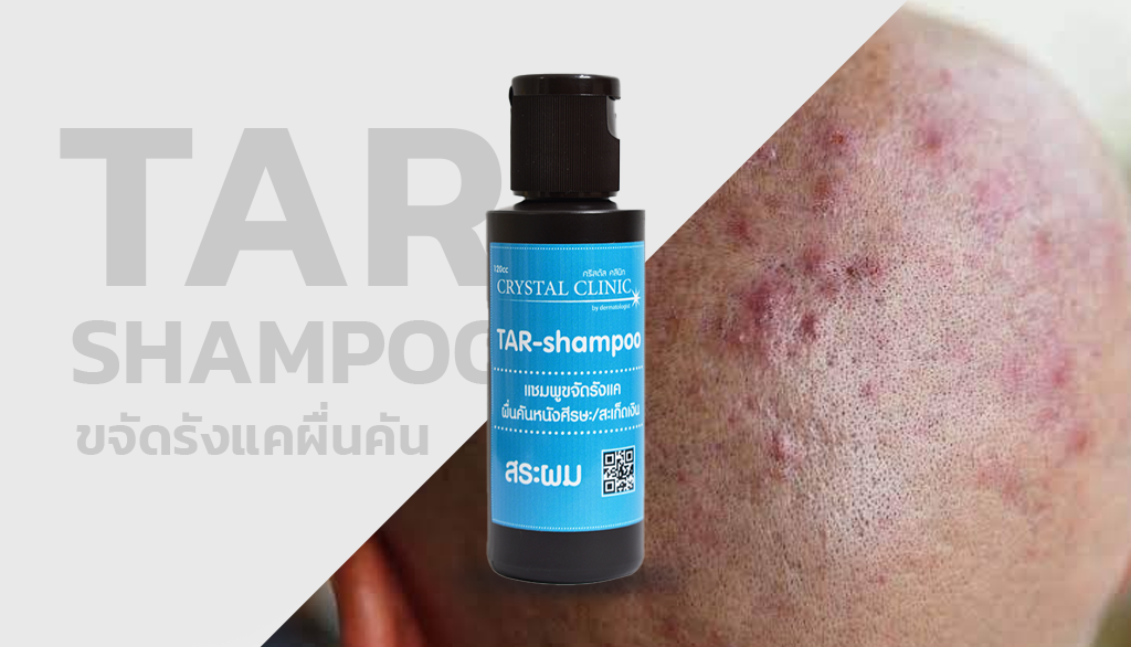 Tar-shampoo