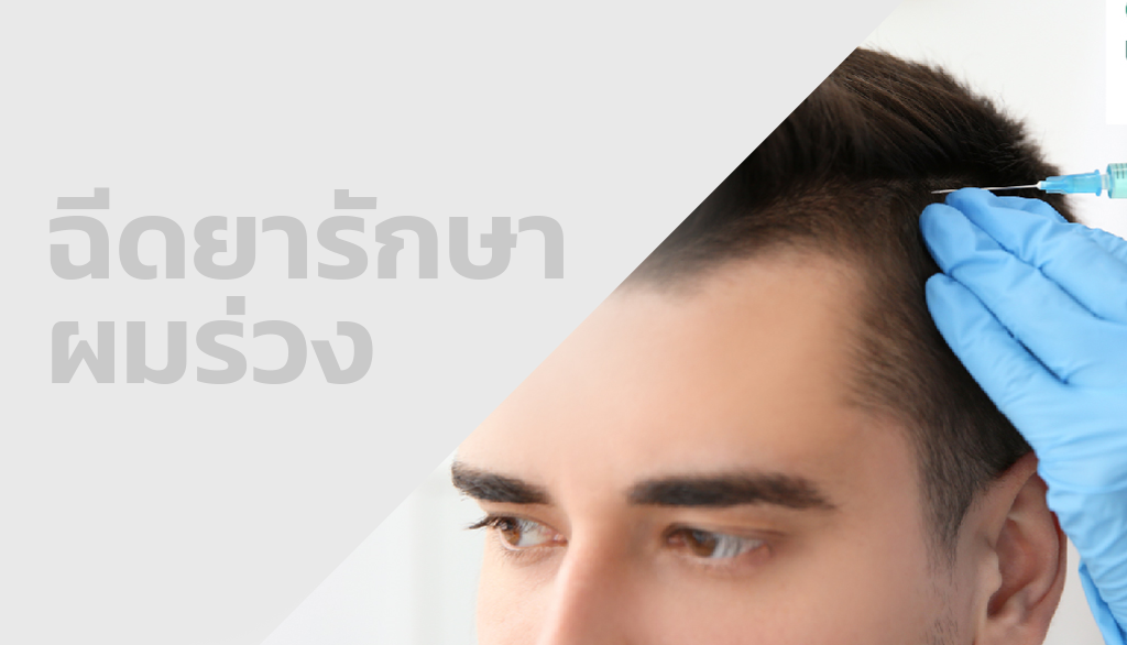 ยาลดอักเสบ
