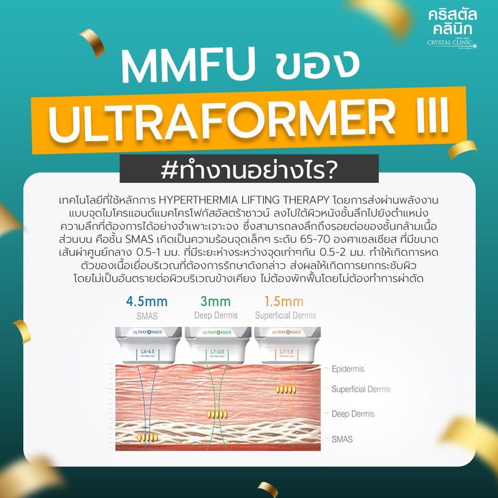 โปรแกรม ULTRAFORMER III คืออะไร โปรแกรม ULTRAFORMER III คืออะไร