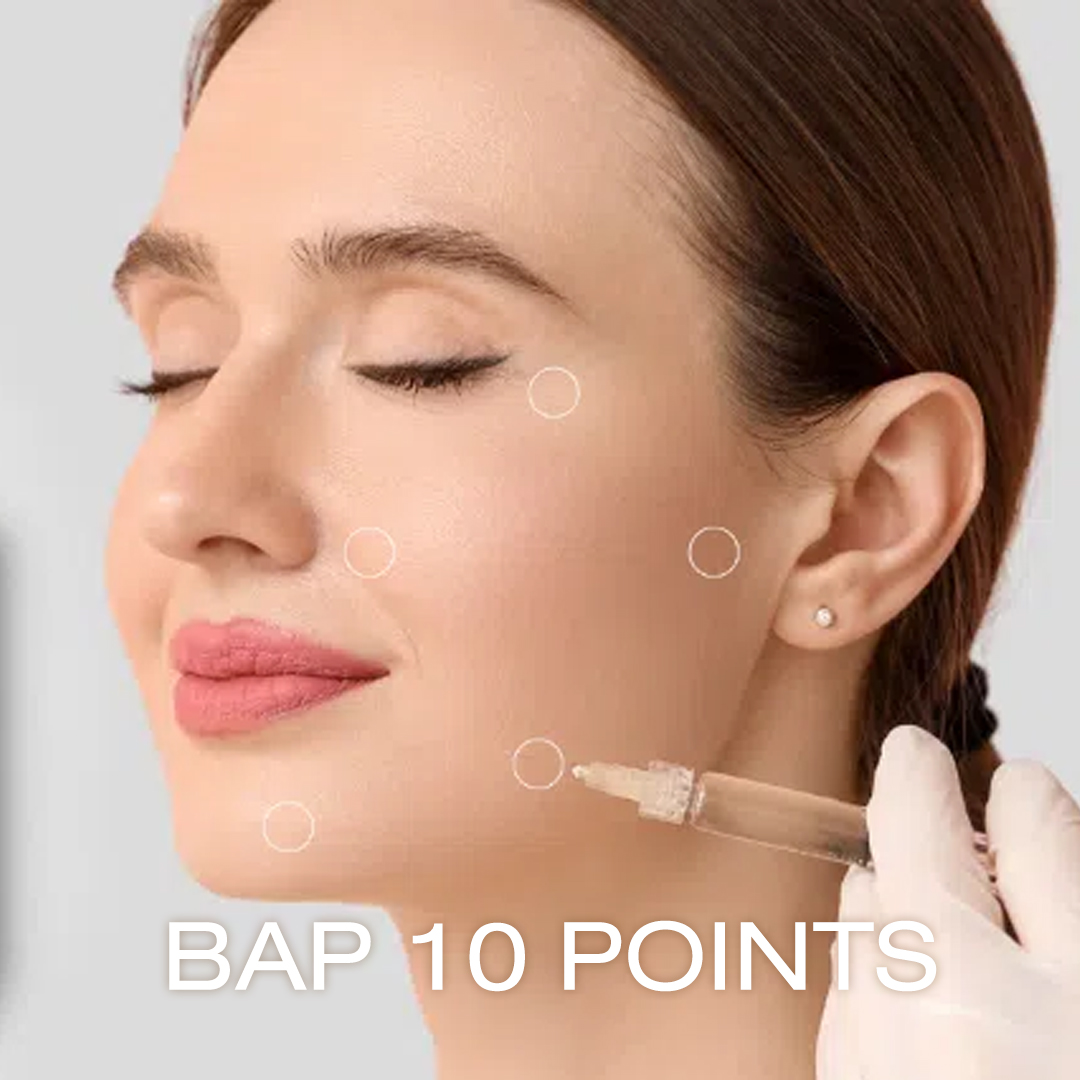 Profhilo BAP 10 Points