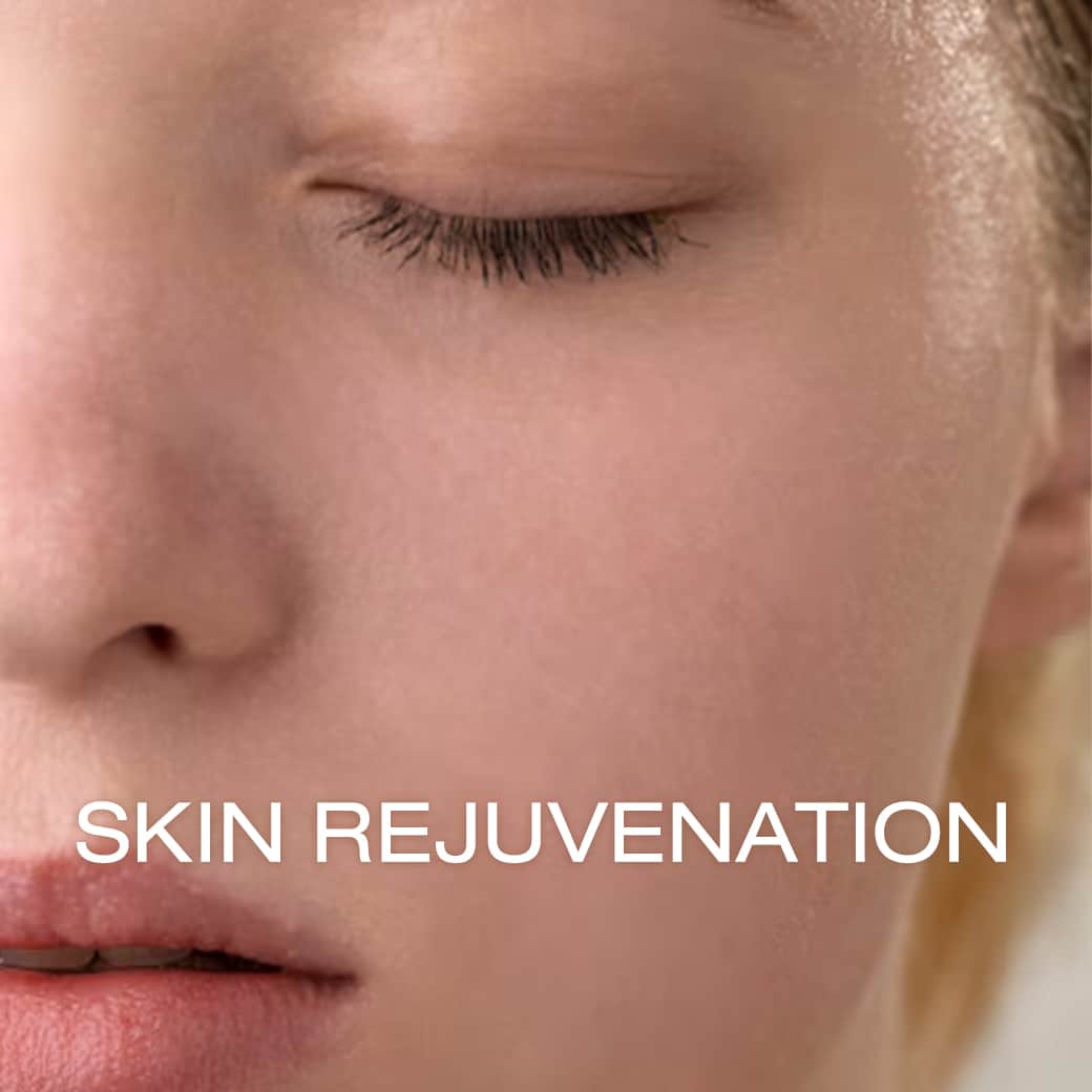Skin Rejuvenation