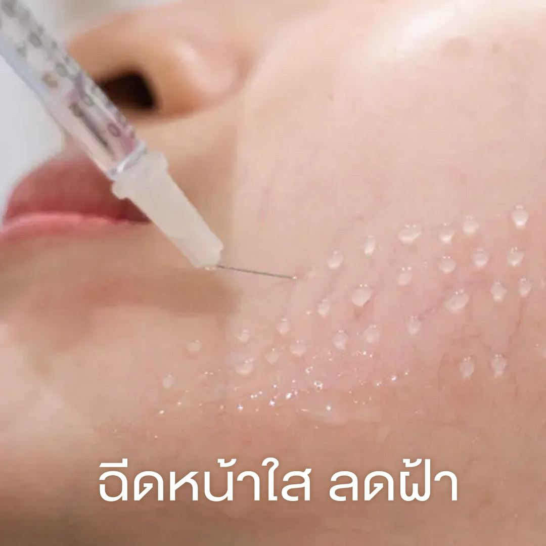 ฉีดหน้าใส