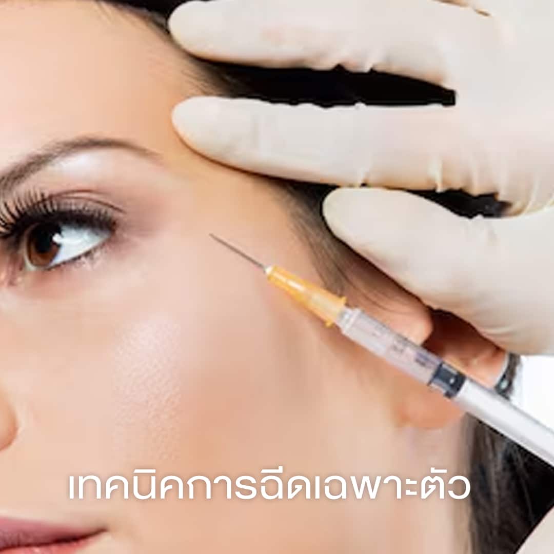 เทคนิคการฉีดเฉพาะตัว