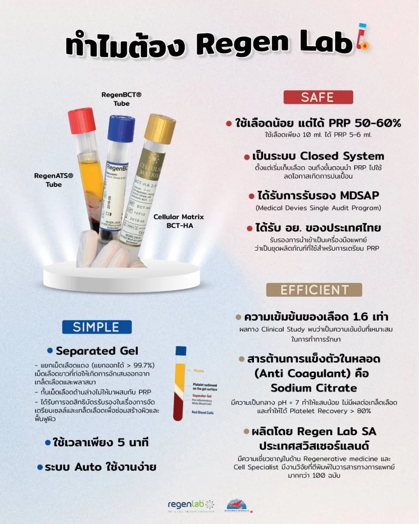 PRP Regen Lab