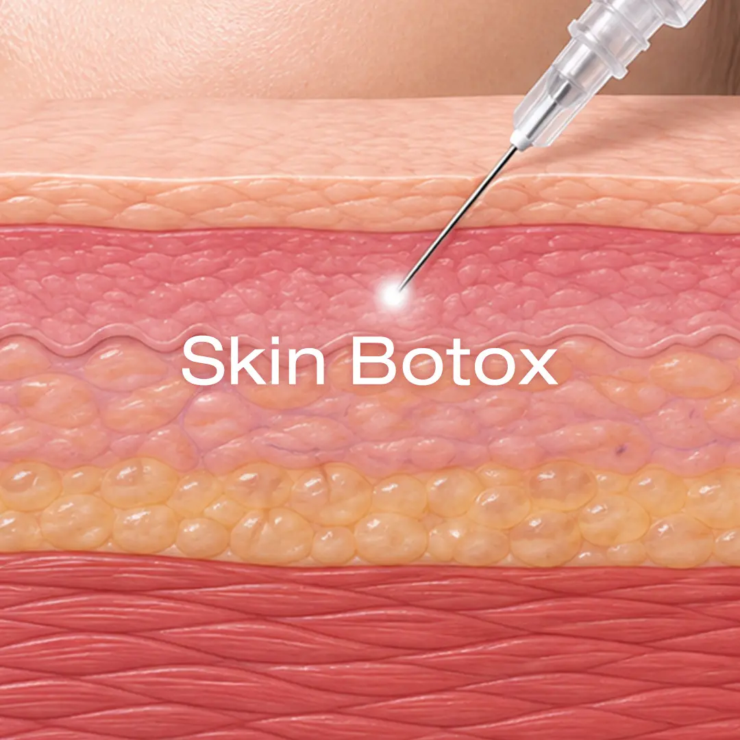 Skin Botox
