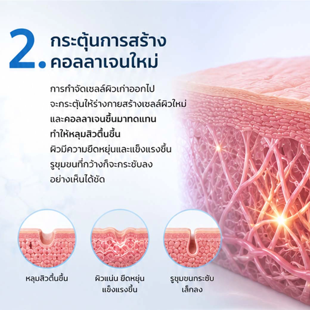Erbium YAG Laser กระตุ้นการสร้างคอลลาเจนใหม่