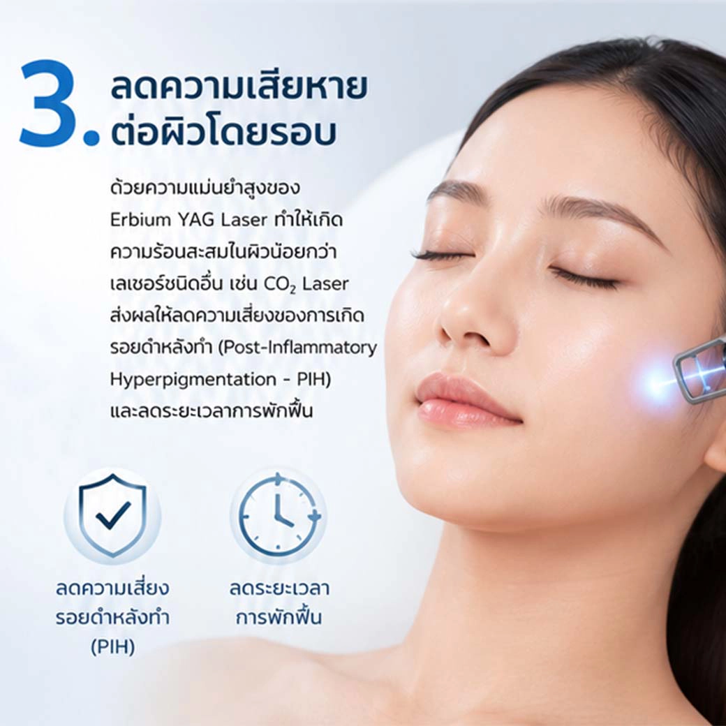 Erbium YAG Laser ลดความเสียหายต่อผิวโดยรอบ