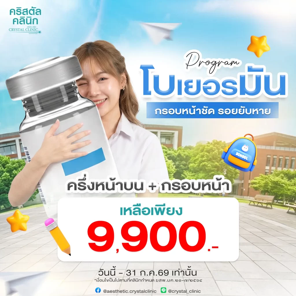 Xeomin-ครึ่งหน้าบน-กรอบหน้า