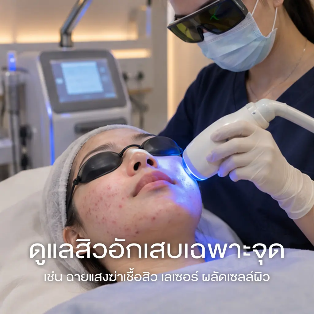 การดูแลสิวอักเสบเฉพาะจุด